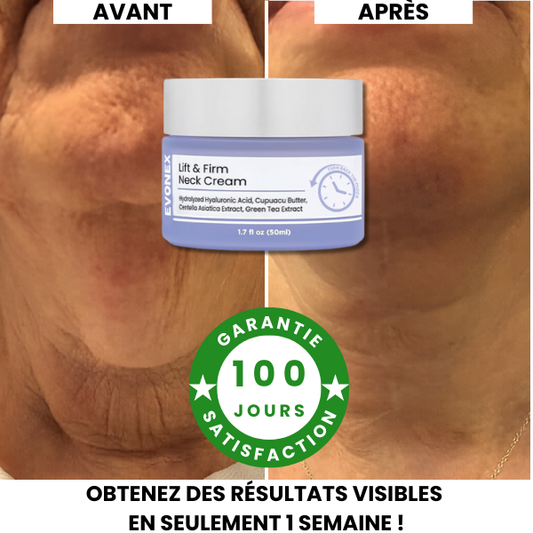 Crème Cou & Décolleté Lift & Fermeté™ Evonex®